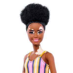 vitiligo barbie 2021