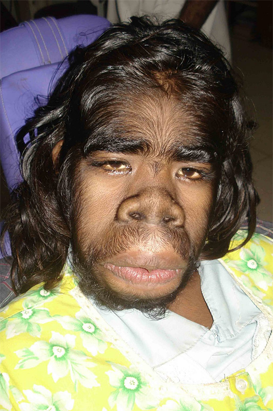 Human Ape Hybrid